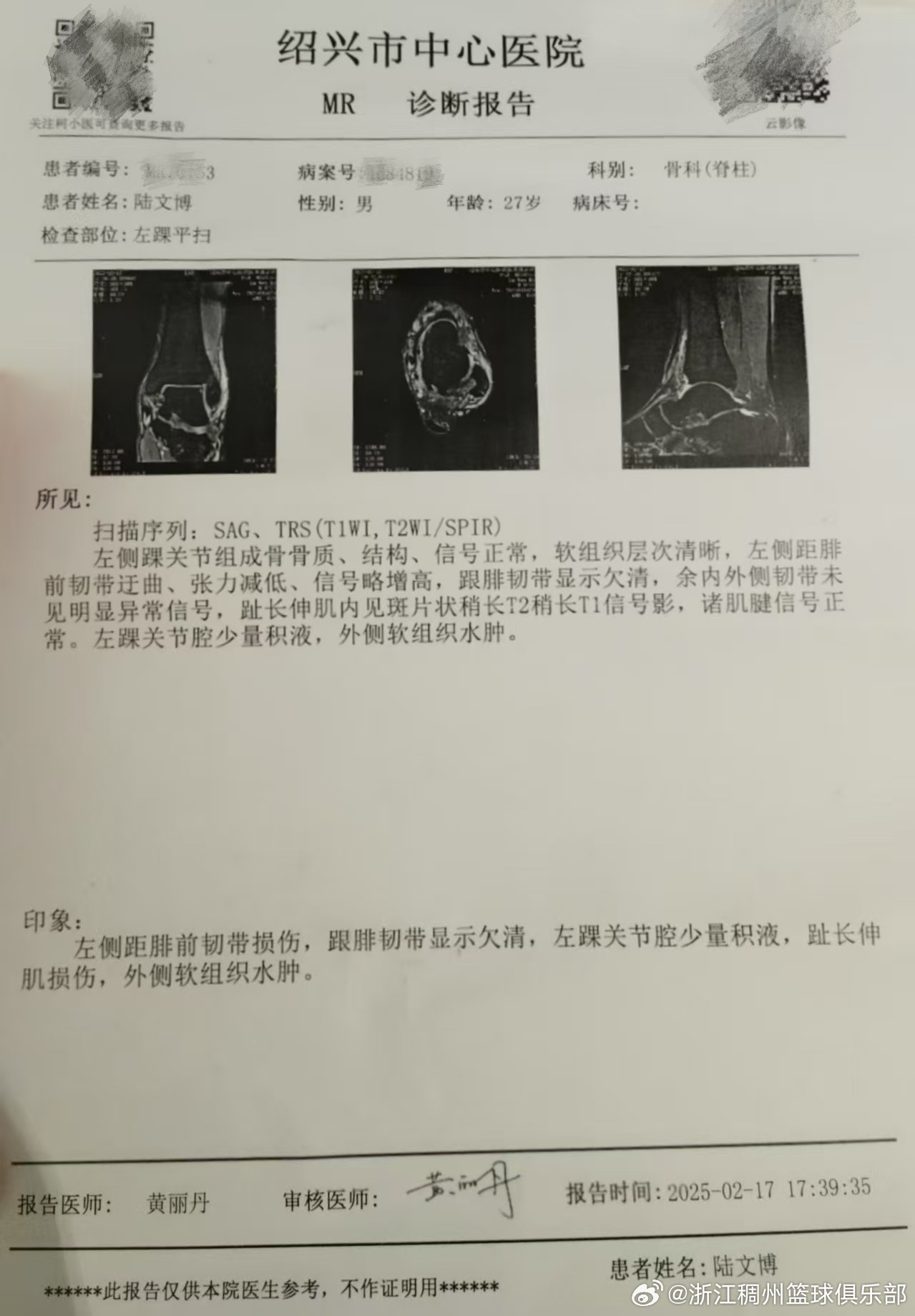 杯中